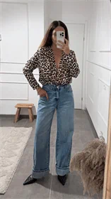 בגד גוף מנומר