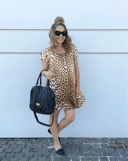 שמלה מנומרת